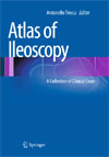 Atlas of Ileoscopy-1
