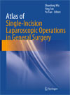 Atlas of Single-Incision Laparoscopic Operations in General Surgery-1