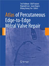 Atlas of Percutaneous Edge-to-Edge Mitral Valve Repair-1