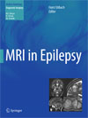 MRI in Epilepsy-1