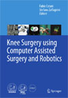 Knee Surgery using Computer Assisted Surgery and Robotics-1