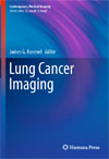 Lung Cancer Imaging-1