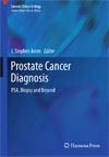 Prostate Cancer Diagnosis-1