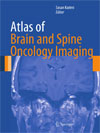 Atlas of Brain and Spine Oncology Imaging-1