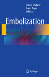 Embolization-1