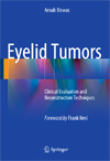 Eyelid Tumors-1