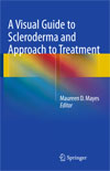 A Visual Guide to Scleroderma and Approach to Treatment-1