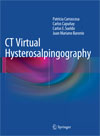 CT Virtual Hysterosalpingography-1