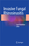 Invasive Fungal Rhinosinusitis-1