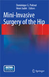 Mini-Invasive Surgery of the Hip-1