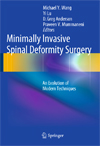 Minimally Invasive Spinal Deformity Surgery-1