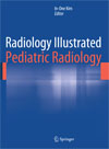 Radiology Illustrated  Pediatric Radiology