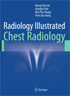 Radiology Illustrated. Chest Radiology
