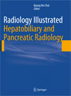 Radiology Illustrated.Hepatobiliary and Pancreatic Radiology