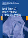 Real-Time 3D Interventional Echocardiography-1