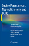Supine Percutaneous Nephrolithotomy and ECIRS-1