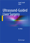 Ultrasound-Guided Liver Surgery-1