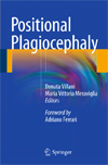 Positional Plagiocephaly-1