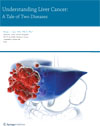 Understanding Liver Cancer-1