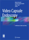 Video Capsule Endoscopy-1