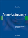 Zoom Gastroscopy-1