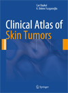 Clinical Atlas of Skin Tumors-1