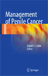 Management of Penile Cancer-1