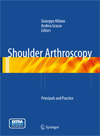 Shoulder Arthroscopy-1