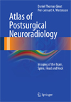 Atlas of Postsurgical Neuroradiology -1