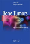 Bone Tumors-1