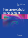 Femoroacetabular Impingement-1