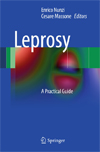Leprosy-1
