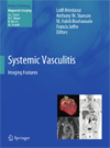 Systemic Vasculitis-1