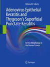 Adenovirus Epithelial Keratitis and Thygeson's Superficial Punctate Keratitis-1