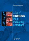 Atlas of Endoscopic Major Pulmonary Resections