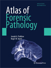 Atlas of Forensic Pathology-1
