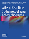 Atlas of Real Time 3D Transesophageal Echocardiography RADIO-1