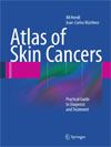 Atlas of Skin Cancers-1