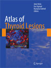 Atlas of Thyroid Lesions -1