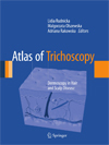 Atlas of Trichoscopy-1