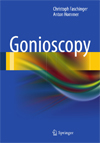Gonioscopy-1