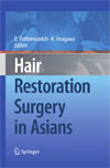 Hair Restoration Surgery in Asians-1