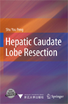 Hepatic Caudate Lobe Resection -1