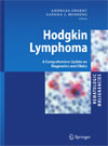 Hodgkin Lymphoma-1