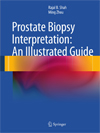 Prostate Biopsy Interpretation