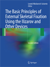 The Basic Principles of External Skeletal Fixation Using the Ilizarov and Other Devices-1