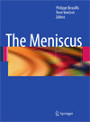 The Meniscus-1