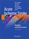 Acute Ischemic Stroke-1