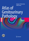 Atlas of Genitourinary Pathology-1