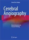Cerebral Angiography-1